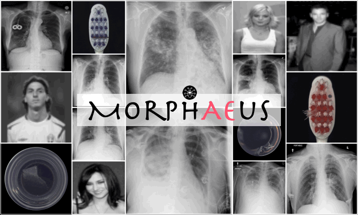 MorphAEus